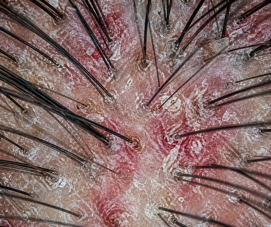 5 Signs Your Scalp Needs Attention (And How to Check at Home)