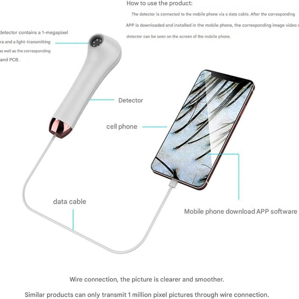 ScalpCam step-by-step diagram showing how to use the scalp detector with a smartphone and data cable for real-time scalp analysis, dandruff detection, and scalp health monitoring.