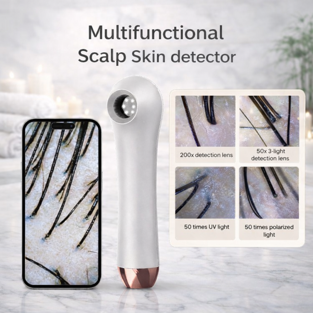 ScalpCam multifunctional scalp skin detector with smartphone app on a marble surface, designed for scalp analysis, dandruff detection, hair root inspection, and scalp health monitoring at home.